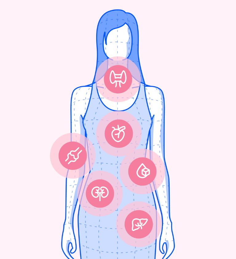 Illustration of health concerns for women above 45